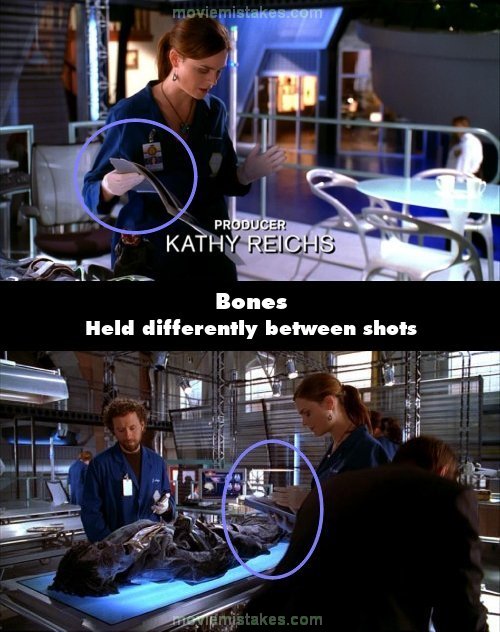 Bones picture