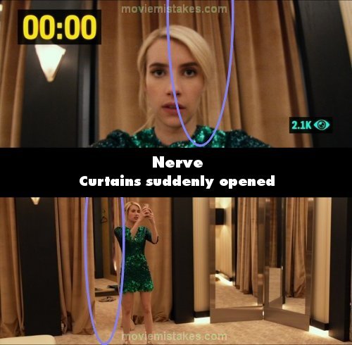 Nerve picture